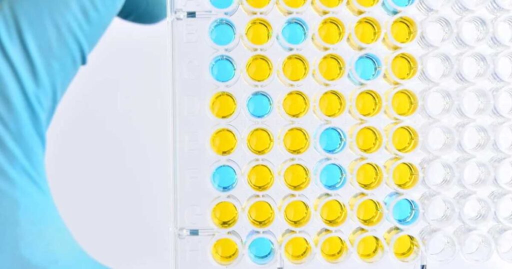 Hand mit Handschuh hält eine 96-Well-Platte für die kundenspezifische Assay-Entwicklung.