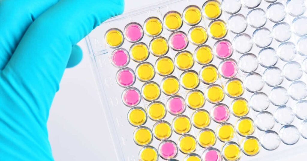 Wissenschaftler prüft eine gelb gefärbte ELISA-Platte für Immunoassay-Services.